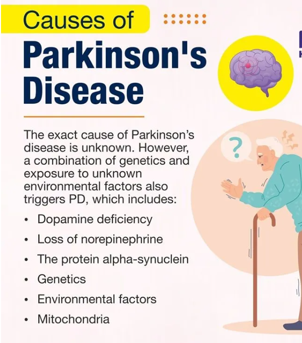 Tiny Gold Particles for Early Detection of Parkinson’s Disease