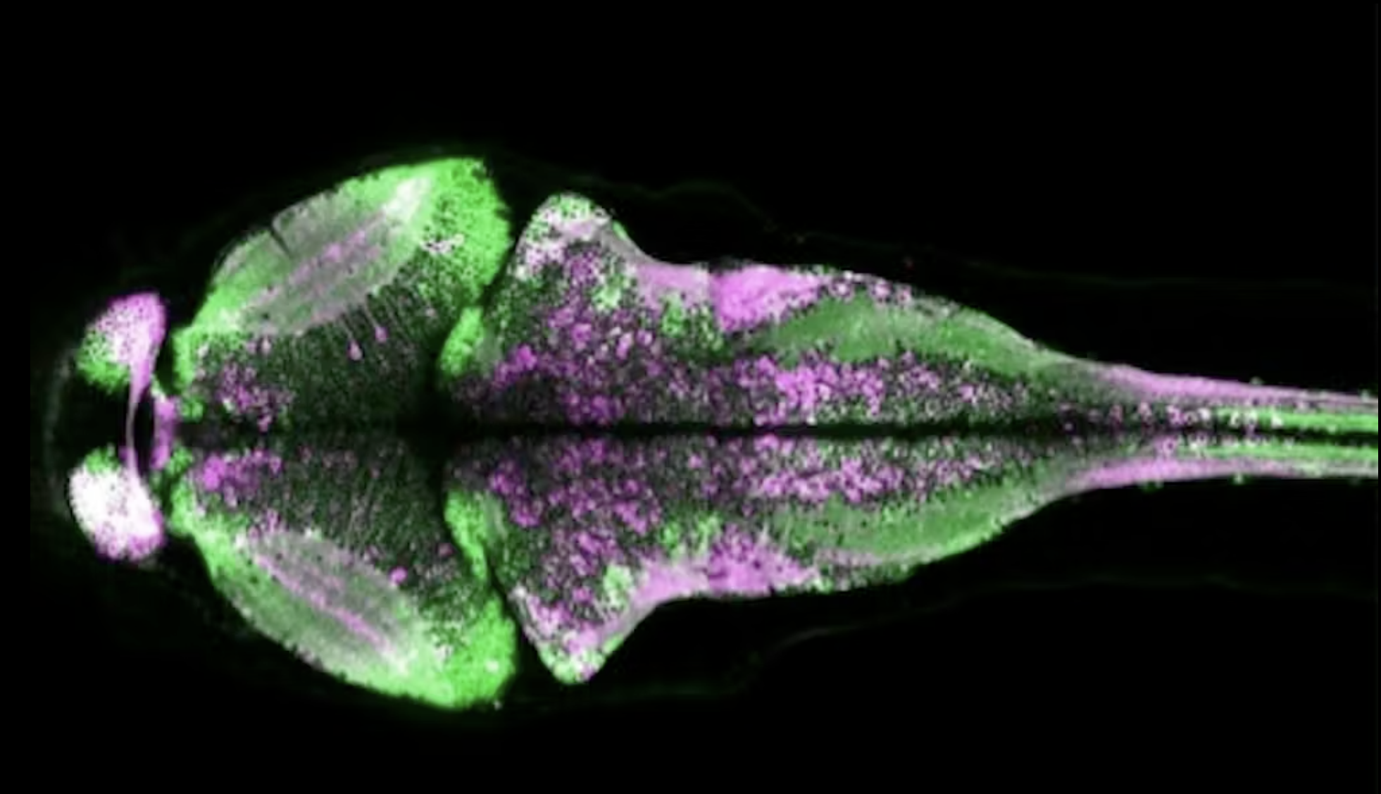 Proteins as quantum sensors inside living cells