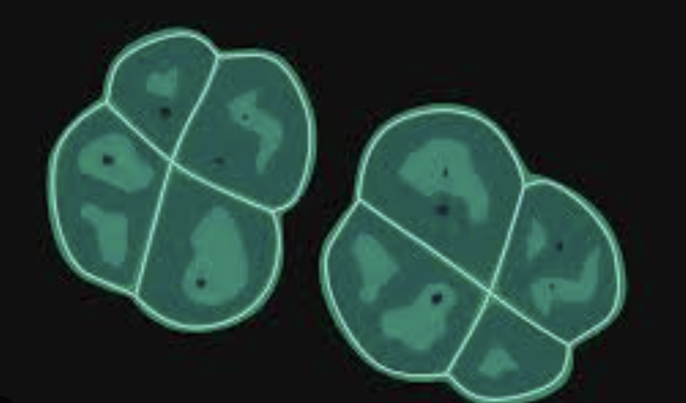 Deinococcus radiodurans 
